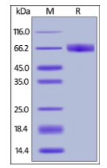 Human IFN-gamma R1, Fc Tag on SDS-PAGE under reducing (R) condition. The gel was stained overnight with Coomassie Blue. The purity of the protein is greater than 95%.
